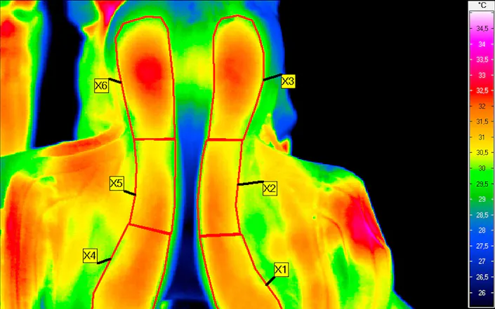 Thermal pattern distributions - Picture credits: journal pone 0221622 g001